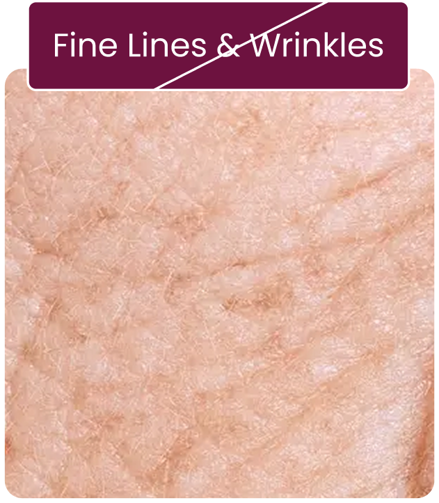 Transtore replace image in en language for Fine_Lines_Wrinkles.png